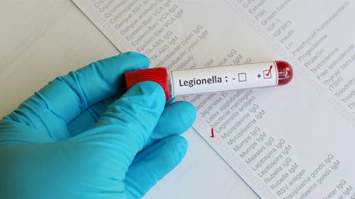 Image related to Legionella - The symptoms to look out for